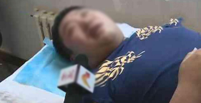  
Một nam bệnh nhân bị liệt dây thần kinh số 7, gây ra hiện tượng méo miệng. (Ảnh: Weibo)