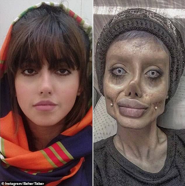  
Sahar từng sở hữu gương mặt xinh đẹp, ưa nhìn trước khi thay đổi. (Ảnh: Daily Mail)