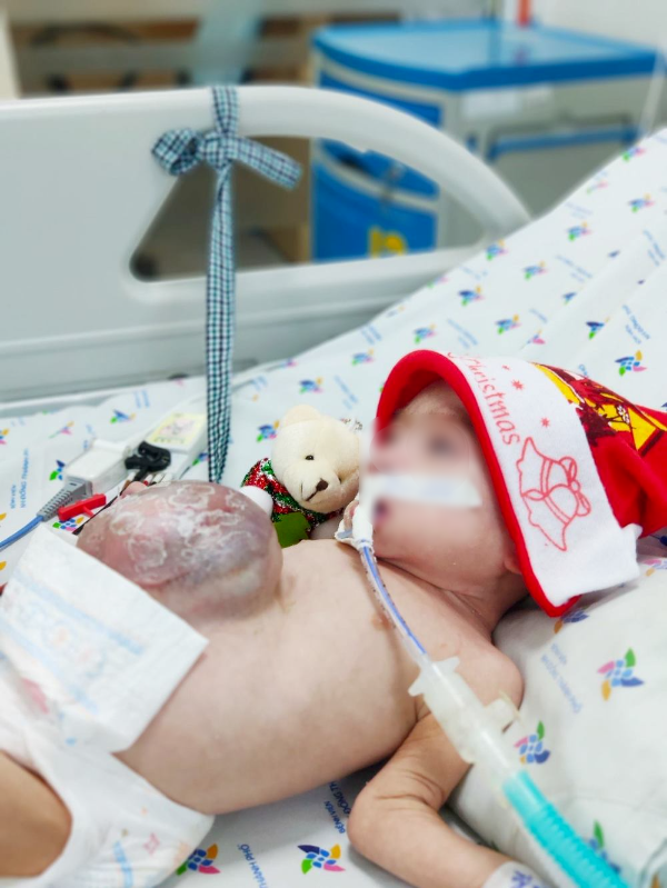 
Một em bé nằm trên giường bệnh với món quà đáng yêu từ các y bác sĩ tại bệnh viện (Nguồn: BV Nhi Đồng)