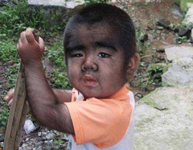  
Hình ảnh cậu bé "người vượn" - Yu Zhenhuan từ thuở nhỏ. (Ảnh: Twitter)