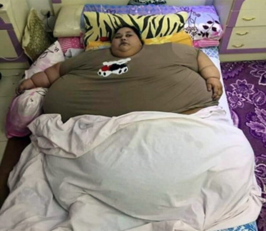  
Eman Ahmed Abd El Aty được biết đến là người phụ nữ nặng nhất thế giới với số cân xấp xỉ 500kg (Ảnh: Mathrubhumi)