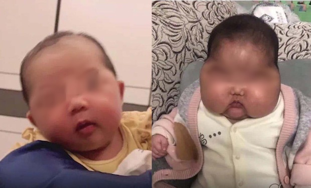  
Hình ảnh bé gái với khuôn mặt bình thường (bên trái) và sau một thời gian dùng loại kem dưỡng trên (bên phải). (Ảnh: Sohu)