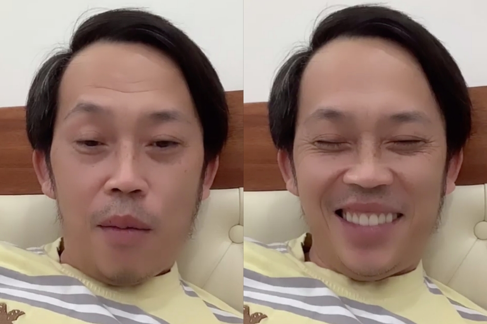 Gương mặt khác lạ khiến nhiều khán giả lo lắng. (Ảnh: Chụp màn hình).