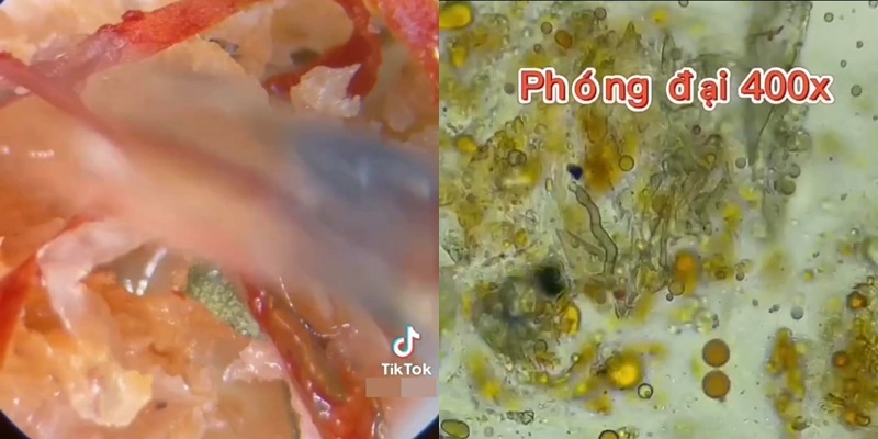 Hình ảnh của nem chua khi được soi dưới kính hiển vi. (Ảnh: Cắt từ clip)
