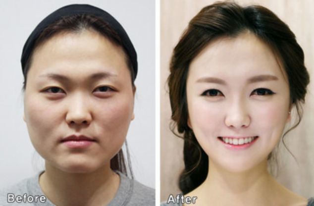  
Một người phụ nữ trông hoàn toàn khác với ảnh hộ chiếu sau khi thực hiện phẫu thuật thẩm mỹ tại Hàn Quốc (Ảnh: Dailymail)