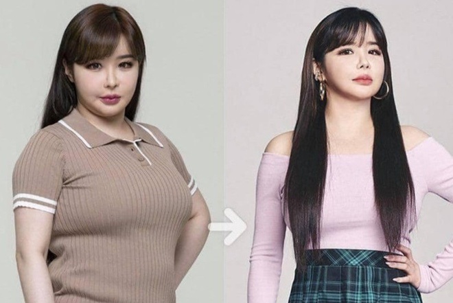  
Park Bom trước và sau giảm cân. (Ảnh: kpopmas)