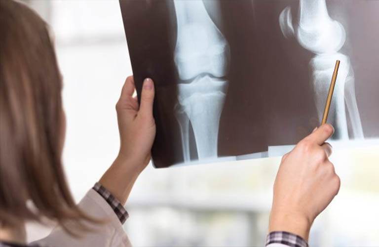  
Chụp X-quang giúp các bác sĩ chẩn đoán bệnh nhanh hơn trong nhiều trường hợp. (Ảnh minh họa: SKĐS)