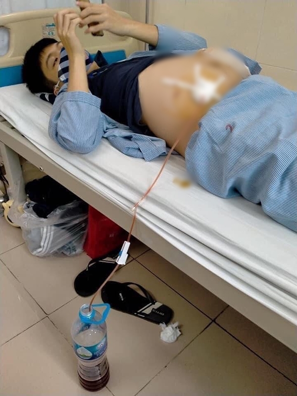  
Toàn đang điều trị tại Bệnh viện K cơ sở Tân Triều. (Ảnh: Đất Việt)