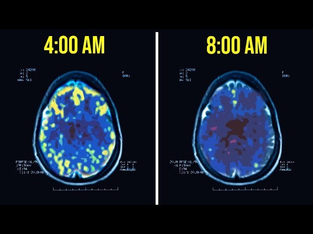  
Hình ảnh sóng não hoạt động của người thức dậy lúc 4h sáng so với 8h sáng. (Ảnh: Commonwealth)