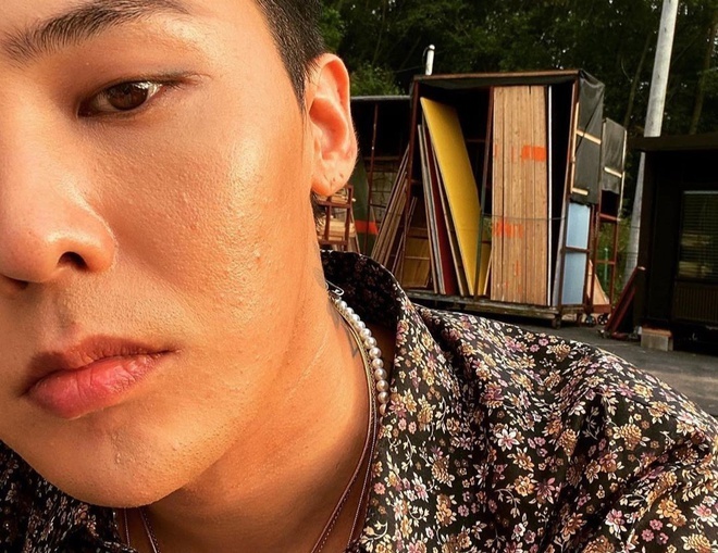 
G-Dragon gây sốt khi đăng ảnh mặt mộc, dân tình liền cảm thấy tự tin hơn với làn da của mình bởi "G-Dragon còn có mụn huống chi người thường". (Ảnh: Instagram)