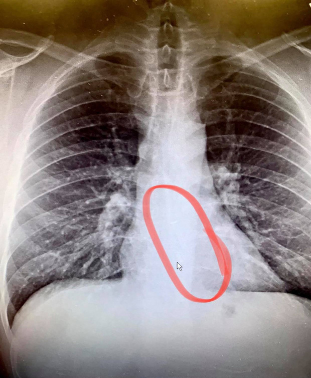  
Hình ảnh chụp X-quang do Gauthier đăng tải. (Ảnh: Cultofmac)