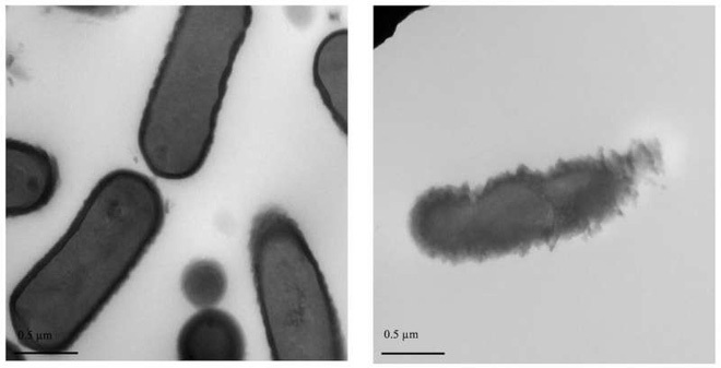  
Hình ảnh vi khuẩn có hại ở trạng thái bình thường (bên trái) và sau khi bị hợp chất có trong nem chua tiêu diệt (bên phải). (Ảnh: Elvina Parlindungan)