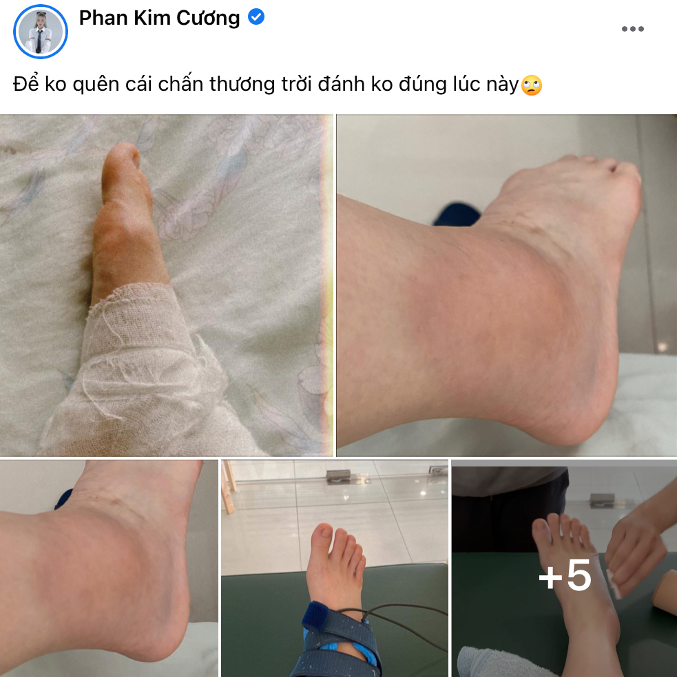 Liz Kim Cương chia sẻ ảnh hậu trường bị chấn thương vì tập nhảy