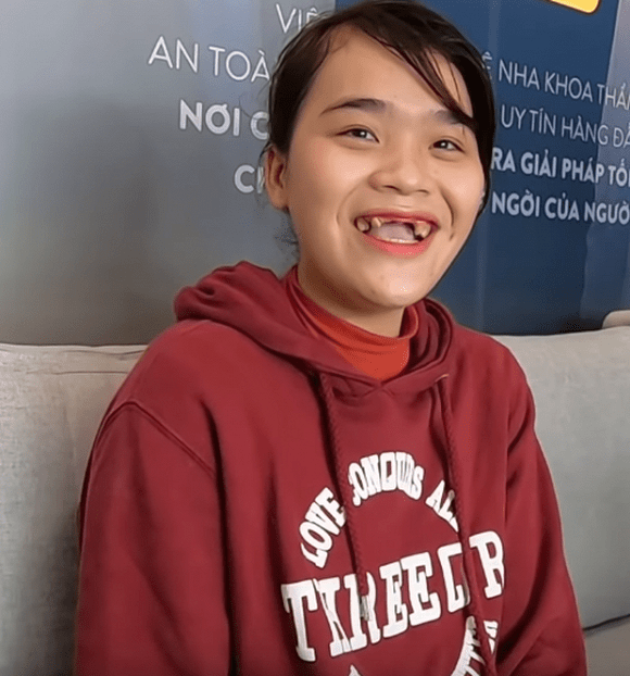 Nhiều sao Việt gặp sự cố về răng trong lúc livestream