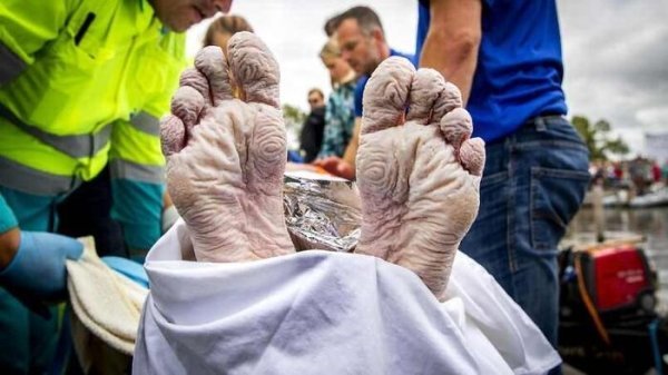 Bàn chân của Maarten Van Der Weijden-nhà vô địch Olympic người Hà Lan sau khi bơi 163 km trong 55 giờ để gây quỹ từ thiện. (Ảnh: Toppressworld24)
Bàn chân của Maarten Van Der Weijden-nhà vô địch Olympic người Hà Lan sau khi bơi 163 km trong 55 giờ để gây quỹ từ thiện. (Ảnh: Toppressworld24)