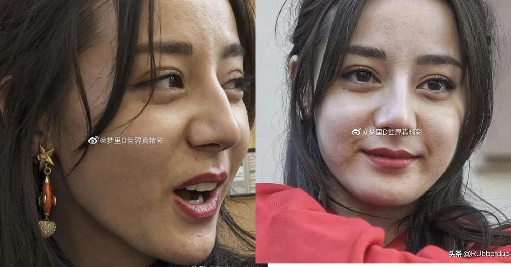  
Khuôn mặt sần sùi, chi chít mụn của người đẹp 29 tuổi. (Ảnh: Weibo)