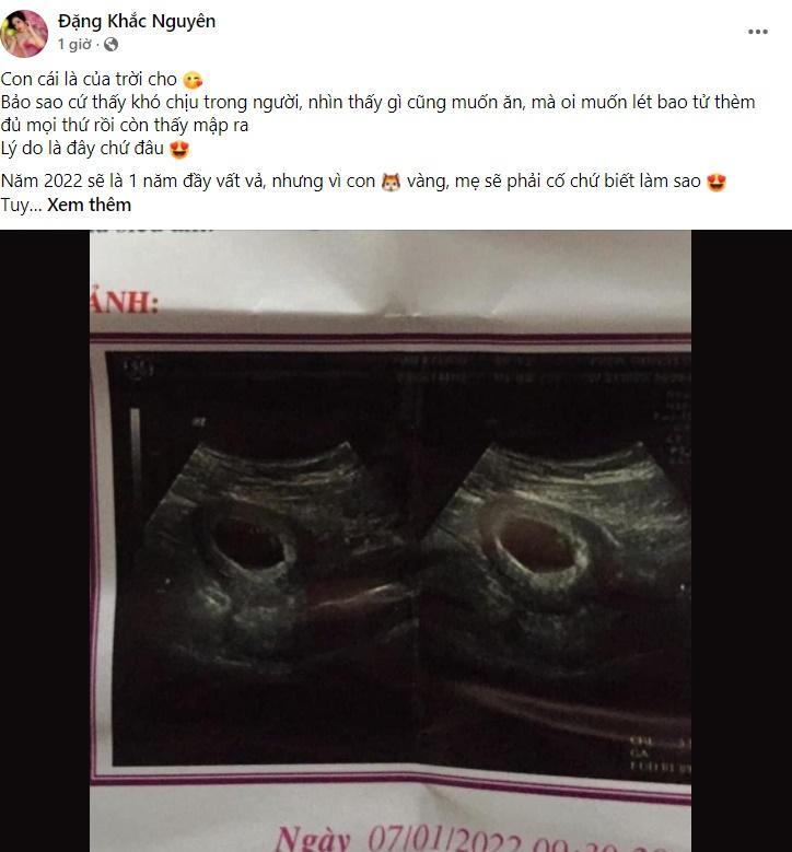  
Minh Anh bất ngờ tiết lộ hình ảnh siêu âm thai nhi khiến nhiều người nghĩ rằng cặp đôi chuẩn bị đón em bé thứ 2. (Ảnh: Chụp màn hình FB Đặng Khắc Nguyên)