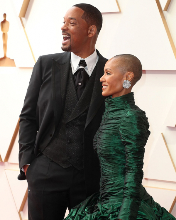  
It is known that Will Smith's wife is suffering from hair loss.  (Photo: Pinterest)