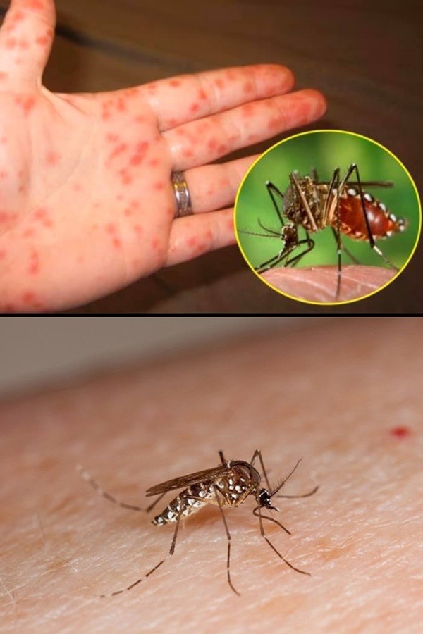 Muỗi vằn là vật trung gian dẫn đến bệnh sốt xuất huyết. (Ảnh: Bộ Y tế)