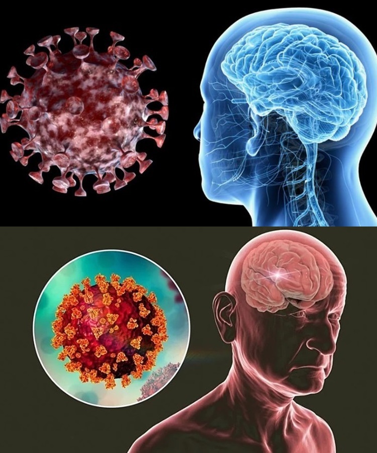  
Viêm não virus thường có diễn biến phức tạp vào mùa hè. (Ảnh: Sức khỏe và Đời sống)