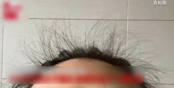    Ban đầu khi áp dụng phương pháp kỳ lạ này, tóc con của Cô Ge cũng có mọc lên. (Ảnh: Sohu)