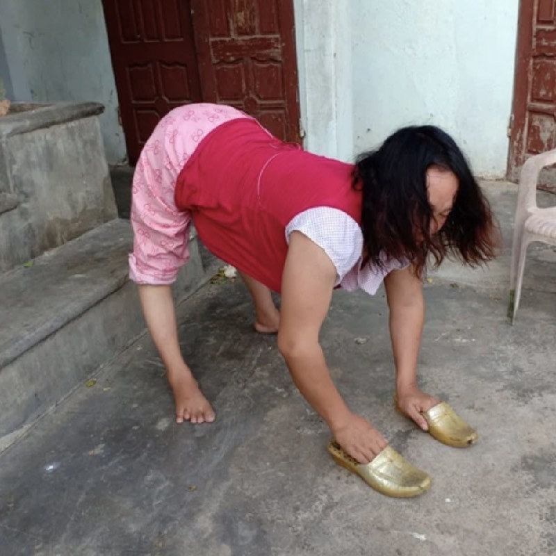  
May mắn con của chị không bị di truyền từ chị. (Ảnh: Dân Sinh)