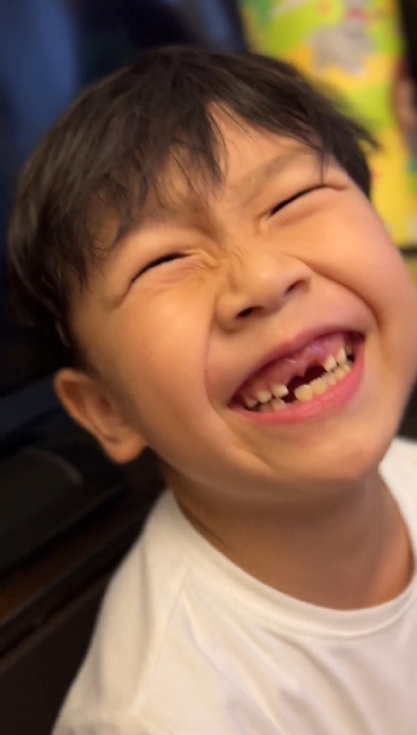 Cậu bé mất 2 răng cửa vì ăn táo, biểu cảm sau đó làm ai cũng bật cười