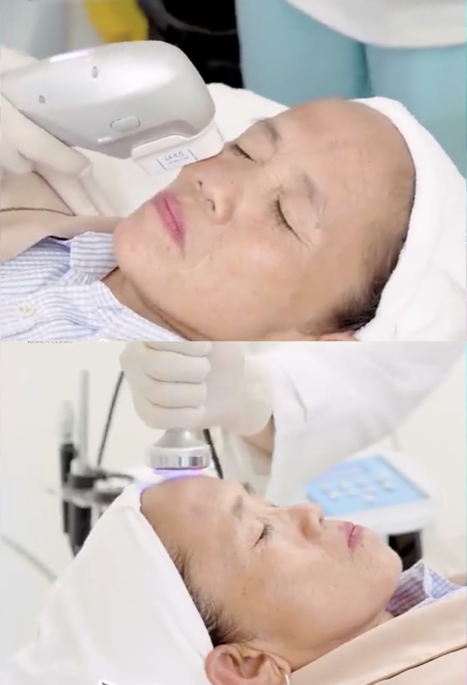 Bà Tân được trải nghiệm công nghệ thẩm mỹ ở tuổi 55. (Ảnh: Chụp màn hình FB K.H.R.)