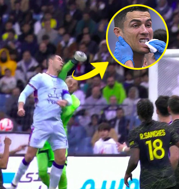  Ronaldo bị đau nhẹ sau khi bị thủ môn đối phương phạm lỗi. (Ảnh: Al Nassr)