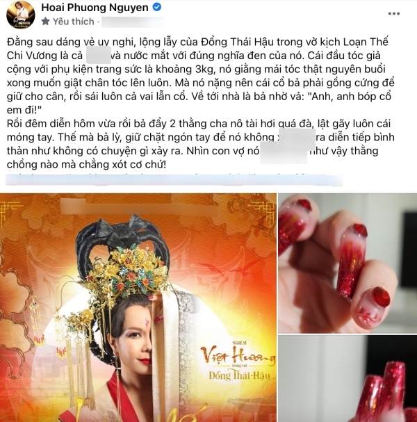  
Chồng Việt Hương xót xa khi vợ bị thương vì vai diễn. (Ảnh: Chụp màn hình FB Hoai Phuong Nguyen) - Tin sao Viet - Tin tuc sao Viet - Scandal sao Viet - Tin tuc cua Sao - Tin cua Sao