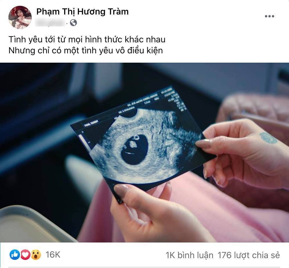  
Cô dính nghi vấn có baby với tấm hình siêu âm. (Ảnh: Phạm Thị Hương Tràm) - Tin sao Viet - Tin tuc sao Viet - Scandal sao Viet - Tin tuc cua Sao - Tin cua Sao