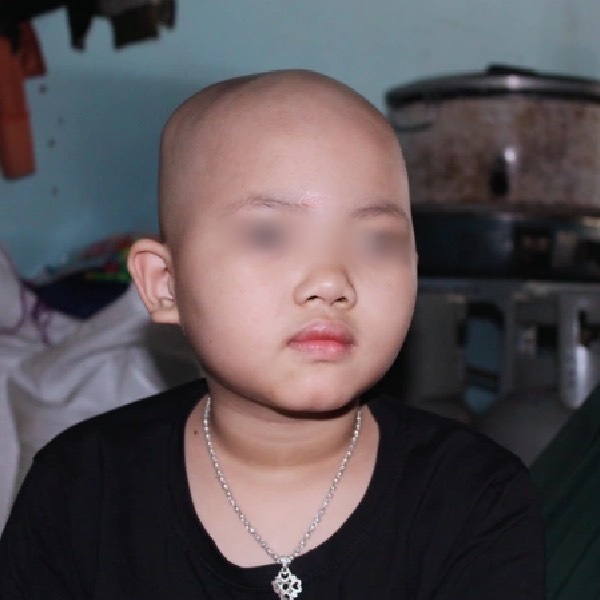  
Hơn 1 năm qua, cô bé Bình An đối chọi với căn bệnh hiểm nghèo. (Ảnh: Dân Trí)