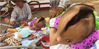 Lại thêm một cậu bé mắc bệnh lạ như người ngoài hành tinh