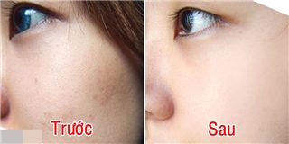 5 công thức thần thánh từ nước mía, cứu làn da trong mùa nóng nực