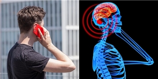 Công bố tài liệu mật chứng minh sóng điện thoại có thể gây ung thư não