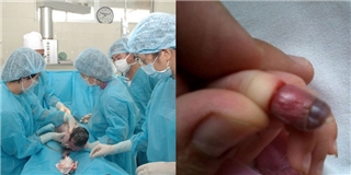 Phẫn nộ bác sĩ “lỡ” cắt cụt ngón tay bé sơ sinh trong lúc mổ bắt thai
