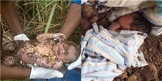 Trẻ sơ sinh sống sót thần kì sau 3 ngày bị mẹ ruột chôn sống