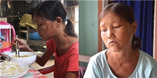Nỗi đau đẫm nước mắt của cô gái dạ dày không đáy ở Quảng Nam