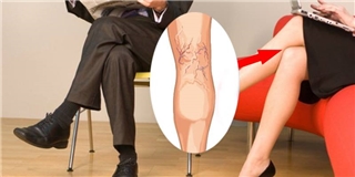 Nam giới hay phụ nữ nếu ngồi chéo chân đều có thể gặp phải tác hại khôn lường