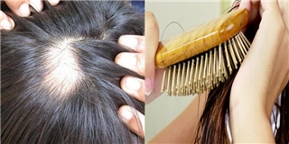 Bạn sẽ bị trọc lóc nếu không không chải tóc theo những bước sau