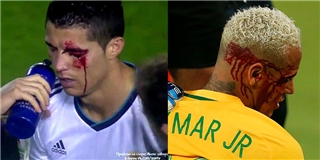 C.Ronaldo, Messi, Neymar và những ngôi sao từng đổ máu trên sân cỏ