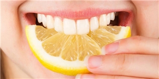 6 loại thực phẩm quen thuộc là “kẻ thù” của hàm răng trắng sáng
