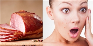 Để giữ làn da sạch mụn, các cô nàng nhớ tránh xa 10 loại đồ ăn này