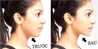 Đánh bay những ngấn mỡ cổ núc ních đáng ghét chỉ với vài bài tập cực kì đơn giản