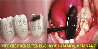 Cuộc chiến răng miệng: Sâu răng liệu có phải là con sâu ngoe ngẩy đang đục khoét trong miệng?