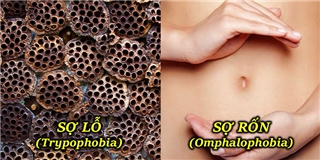 7 nỗi sợ kỳ lạ gây ám ảnh hàng trăm triệu người trên thế giới