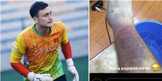 Dính thương chấn nặng, Đặng Văn Lâm chính thức chia tay Hải Phòng?