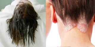 Không muốn sống chung với một đống vi khuẩn thì nhớ đừng để tóc còn ướt rồi đi ngủ nhé!