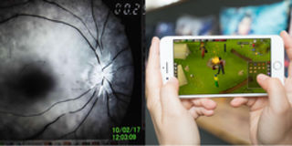Cảnh báo: "Cày game" nhiều trên điện thoại có thể dẫn đến mù mắt