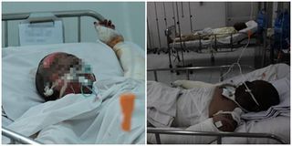 Phát hiện vợ ngủ với nhân tình, chồng dùng xăng thiêu luôn cả 2 bị bỏng nặng